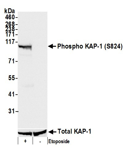 Phospho-KAP-1 (Ser824) Antibody in Western Blot (WB)