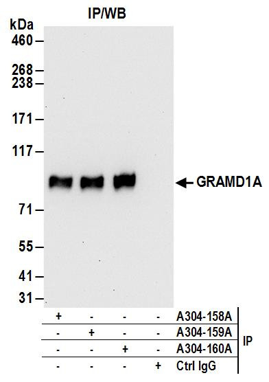GRAMD1A Antibody in Immunoprecipitation (IP)