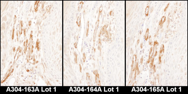 Caldesmon Antibody in Immunohistochemistry (Paraffin) (IHC (P))