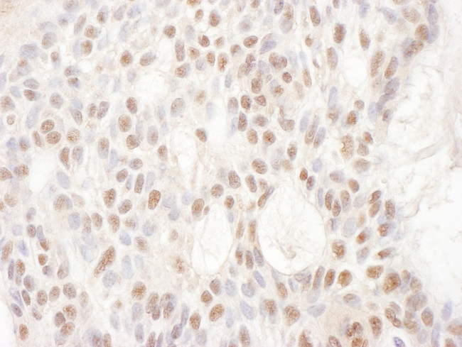 CDKL5 Antibody in Immunohistochemistry (Paraffin) (IHC (P))