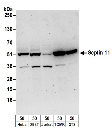Septin 11 Antibody in Western Blot (WB)