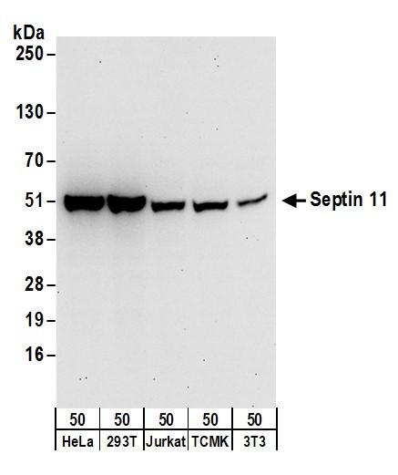 Septin 11 Antibody in Western Blot (WB)