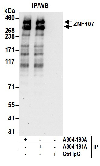 ZNF407 Antibody in Immunoprecipitation (IP)