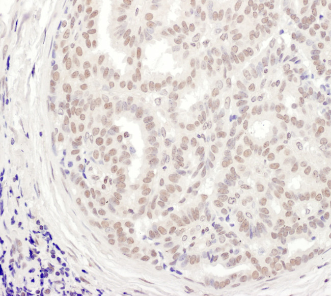 MEPCE Antibody in Immunohistochemistry (Paraffin) (IHC (P))