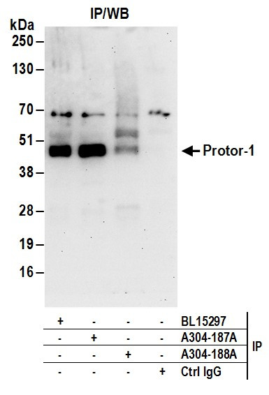 Protor-1 Antibody in Immunoprecipitation (IP)