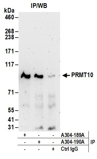 PRMT10 Antibody in Immunoprecipitation (IP)