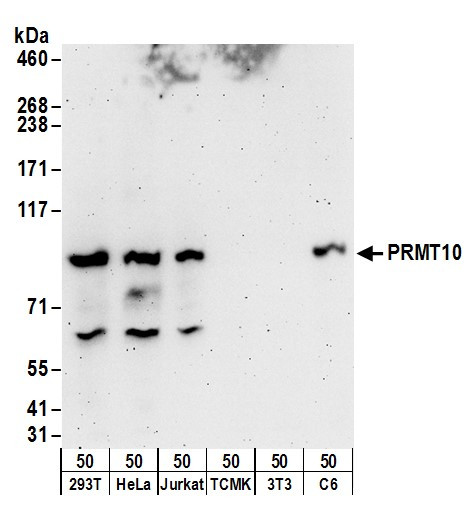 PRMT10 Antibody in Western Blot (WB)