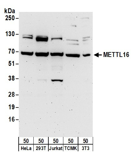 METTL16 Antibody in Western Blot (WB)