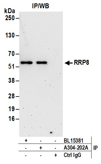 RRP8 Antibody in Immunoprecipitation (IP)