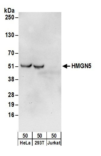 HMGN5 Antibody in Western Blot (WB)