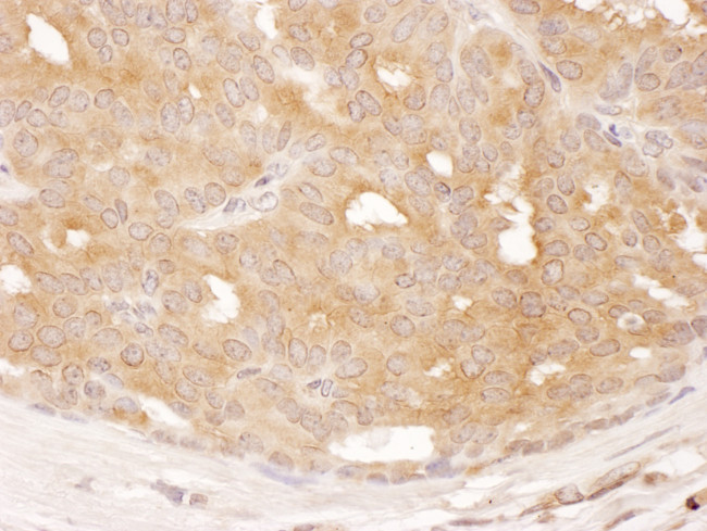 DYNC1LI1 Antibody in Immunohistochemistry (Paraffin) (IHC (P))