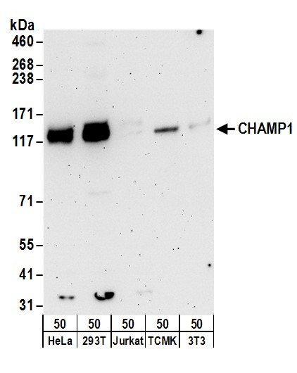 CHAMP1 Antibody in Western Blot (WB)