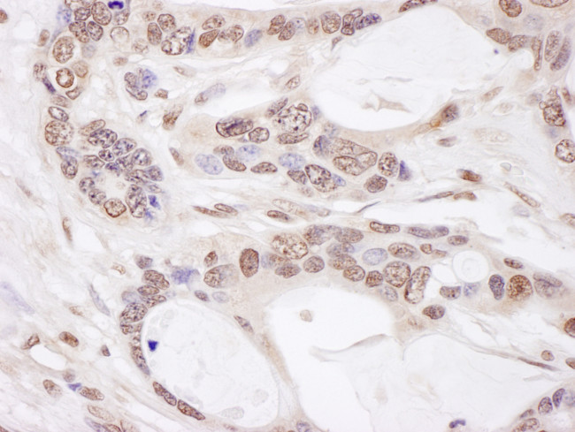 CHAMP1 Antibody in Immunohistochemistry (Paraffin) (IHC (P))