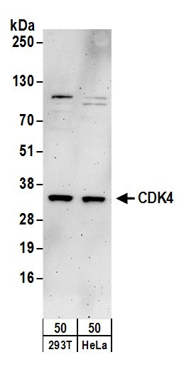 CDK4 Antibody in Western Blot (WB)