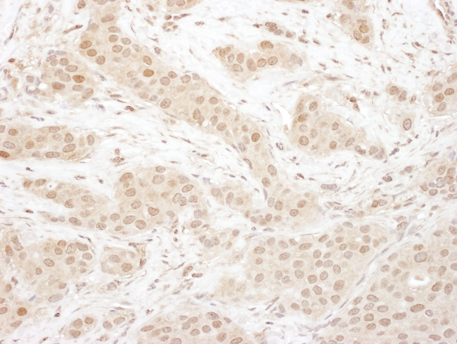 CDK4 Antibody in Immunohistochemistry (Paraffin) (IHC (P))