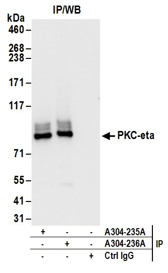 PKC-eta Antibody in Immunoprecipitation (IP)