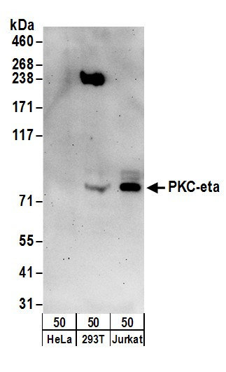 PKC-eta Antibody in Western Blot (WB)