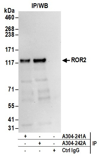ROR2 Antibody in Immunoprecipitation (IP)