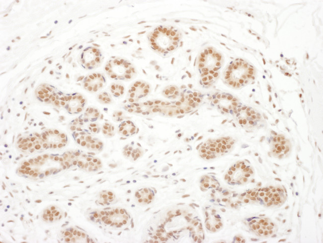 RSK3 Antibody in Immunohistochemistry (Paraffin) (IHC (P))
