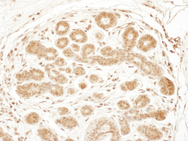 RSK3 Antibody in Immunohistochemistry (Paraffin) (IHC (P))