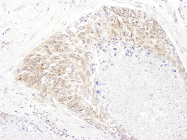 SHMT1 Antibody in Immunohistochemistry (Paraffin) (IHC (P))