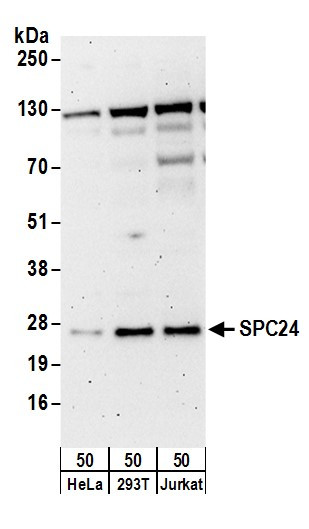 SPC24 Antibody in Western Blot (WB)
