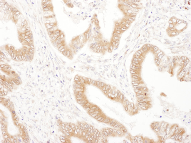 RPN2 Antibody in Immunohistochemistry (Paraffin) (IHC (P))