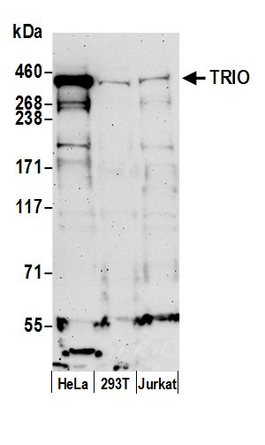TRIO Antibody in Western Blot (WB)
