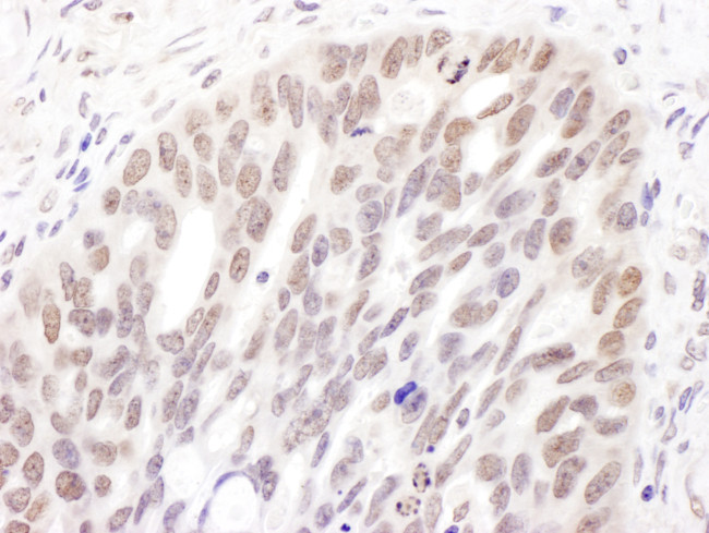 DNMT3A Antibody in Immunohistochemistry (Paraffin) (IHC (P))