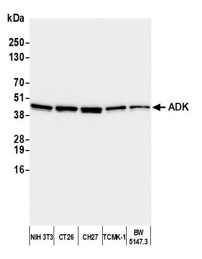 ADK Antibody in Western Blot (WB)