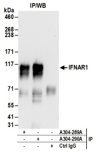 IFNAR1 Antibody in Immunoprecipitation (IP)