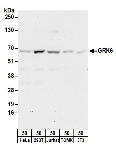 GRK6 Antibody in Western Blot (WB)
