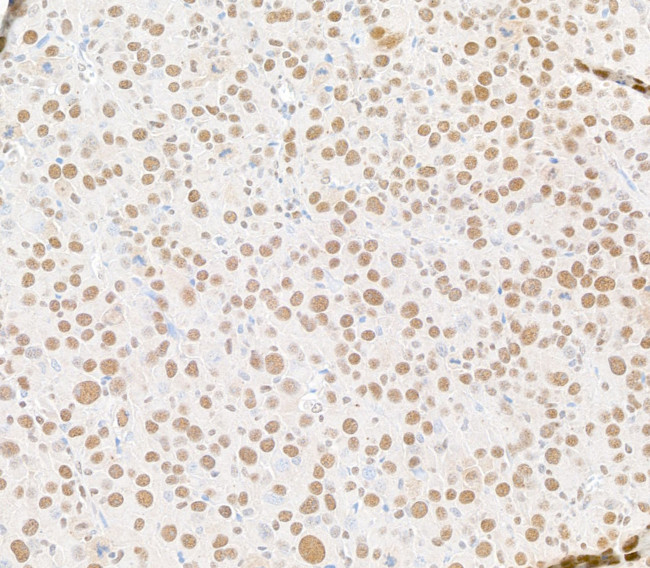 DPY30 Antibody in Immunohistochemistry (Paraffin) (IHC (P))