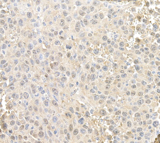 RAN Antibody in Immunohistochemistry (Paraffin) (IHC (P))
