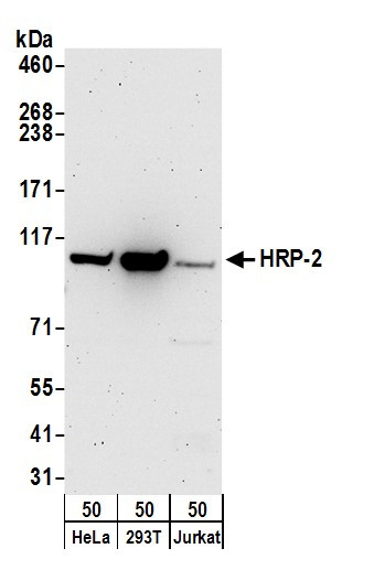 HRP-2 Antibody in Western Blot (WB)