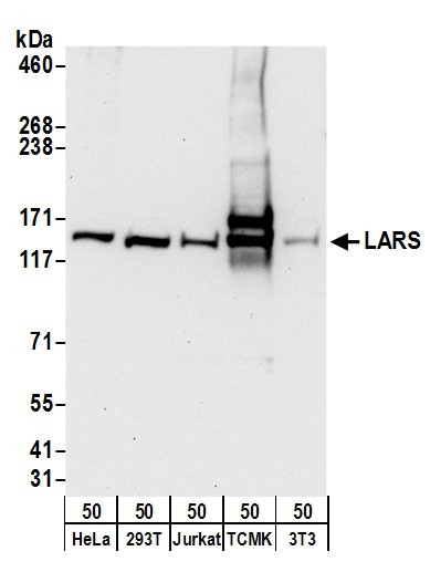 LARS Antibody in Western Blot (WB)
