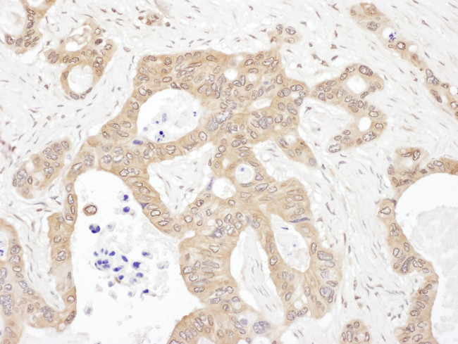 LARS Antibody in Immunohistochemistry (Paraffin) (IHC (P))