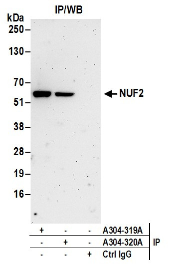 NUF2 Antibody in Immunoprecipitation (IP)