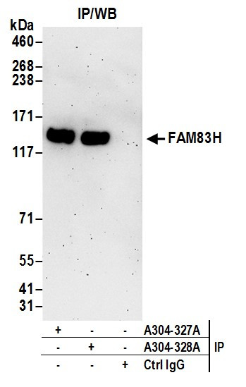 FAM83H Antibody in Immunoprecipitation (IP)