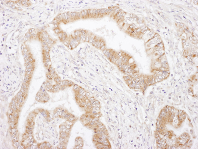 Rictor Antibody in Immunohistochemistry (Paraffin) (IHC (P))