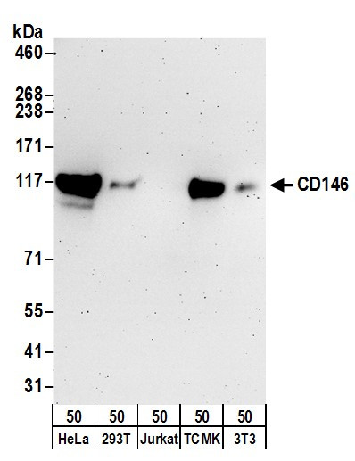 CD146 Antibody in Western Blot (WB)