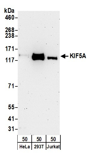 KIF5A Antibody in Western Blot (WB)
