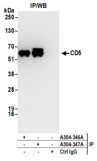 CD5 Antibody in Immunoprecipitation (IP)