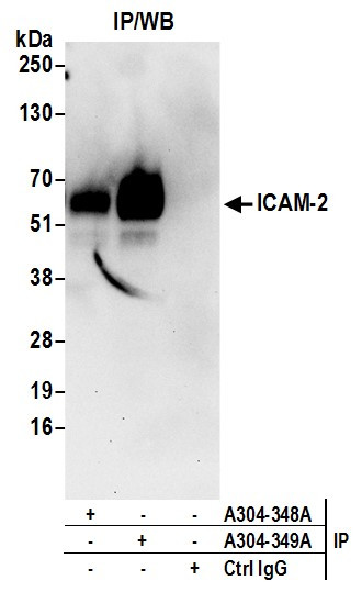 ICAM-2 Antibody in Immunoprecipitation (IP)