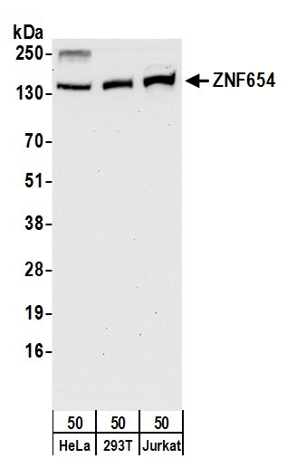 ZNF654 Antibody in Western Blot (WB)