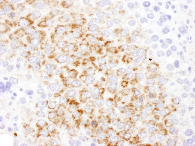 GOT2 Antibody in Immunohistochemistry (Paraffin) (IHC (P))