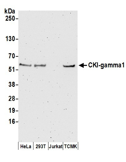 CKI-gamma1 Antibody in Western Blot (WB)