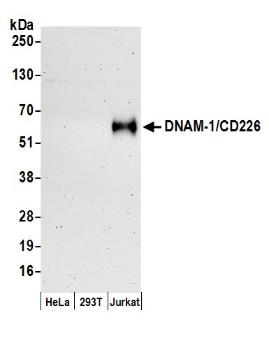 DNAM-1/CD226 Antibody in Western Blot (WB)