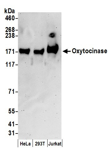 Oxytocinase Antibody in Western Blot (WB)