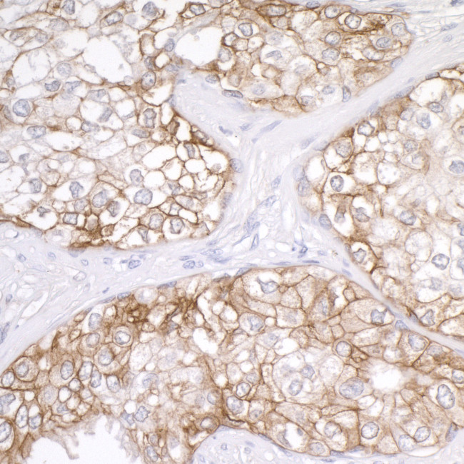 B7-H3/CD276 Antibody in Immunohistochemistry (Paraffin) (IHC (P))